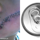 Illustration for article titled A Boy Needed 38 Stitches After a Frozen Soda Can Exploded in His Face
